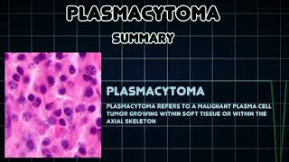 Plasmacytoma [upl. by Siednarb]