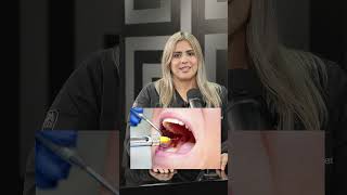 7 things you should know AFTER getting a ROOT CANAL TREATMENT By Dr Michelle Vargas [upl. by Sugihara]