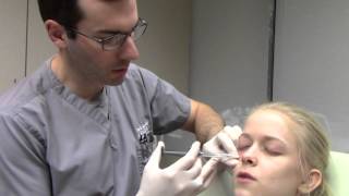 Juvederm VOLUMA injected under the eyes with Dr Seiler [upl. by Kevon]