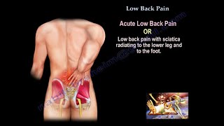 Low Back Pain  Everything You Need To Know  Dr Nabil Ebraheim [upl. by Eceinaj566]