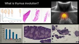 What is thymus INVOLUTION [upl. by Screens]