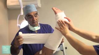 Varicose Veins Endovenous Laser Ablation EVLA and Sclerotherapy treatment  Birmingham [upl. by Finah]