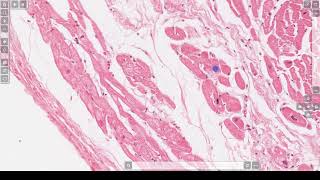 LG14 Normal Cardiac Histology 3 min [upl. by Aliza251]