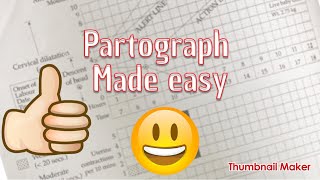 partograph made easy [upl. by Ahsap]