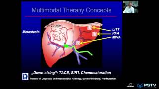 Professor Vogel Intervention Oncology [upl. by Ehgit]