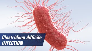 Clostridium difficile infection [upl. by Lrem]