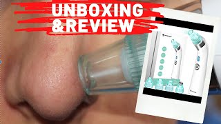 BLACKHEAD REMOVER VACUUM by FITFORT  Unboxing  Review [upl. by Nylisoj]