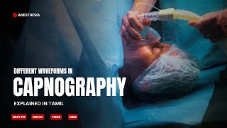 Different waveforms in Capnography  Explained in Tamil  NEET PG  INICET  MRB  FMGE [upl. by Boggers]