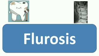 Flurosis  Affect Teeth Skeletal amp other system of body Causes Symptoms Diagnosis Treatment [upl. by Baseler]