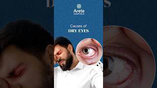 What Are the Causes of Dry Eyes  Dr Balki Satya Prasad dryeyes [upl. by Innos]