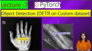 L7  DETR  Object detection Using Detection Transformer on custom dataset [upl. by Yonah]