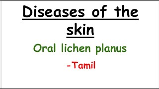 Oral lichen planus oral pathology tamil [upl. by Allianora862]