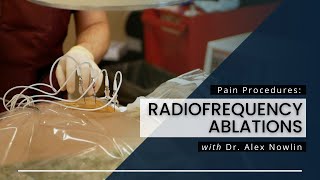 Radiofrequency Ablations What You Should Know [upl. by Joashus947]