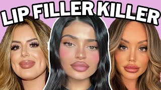 lip fillers will ruin you [upl. by Estella]