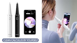 Remove Dental Calculus By Yourself SUNUO T12 Pro Visual Ultrasonic Dental Scaler  KEPMOV [upl. by Millwater]