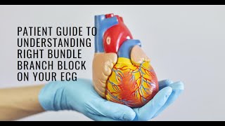 Understanding Right Bundle Branch Block RBBB on Your ECG A Patient Guide [upl. by Haerr563]