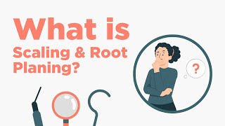 Scaling amp Root Planing  Everything You Need to Know [upl. by Waring]