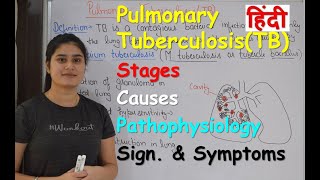 Urinary tract infection  UTI  Signs  Symptoms amp Treatment Hindi [upl. by Lashonda891]