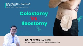 Colostomy Vs Ileostomy  Colostomy vs Ileostomy Difference  Dr Praveen Kamar Mumbai [upl. by Ehr]