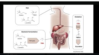 mystery diagnosis trimethylaminuria [upl. by Kanter]