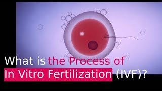 IVF PROCESS HELPFUL STEP BY STEP GUIDE In Vitro Fertilization [upl. by Garaway543]