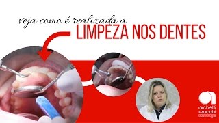 Higiene bucal veja como é realizada a limpeza dental profilaxia [upl. by Notlem]