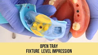 Open Tray  Fixture Level Impression [upl. by Dickerson]