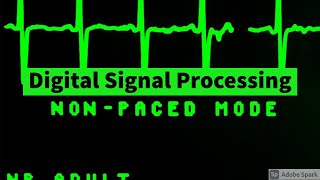 DSP  L8  Solving 8 point DFT of a time domain sequence with its magnitude and phase angle [upl. by Verras258]