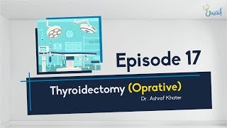 Thyroidectomy Oprative 01  Surgery  Prof Ashraf Khater [upl. by Bartlett]