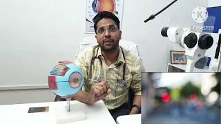 आंख में काला पानी काला मोतियाबिंद GLAUCOMA से आंखों की रोशनी कैसे चली जाती है Dr praveen Garg [upl. by Adoree]