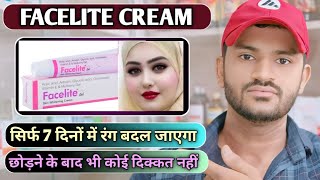 Facelite cream uses dose benefits and Side effects full review in hindi [upl. by Lissa]