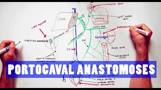 Portocaval Anastomoses  ANATOMY Tutorial [upl. by Coffeng370]