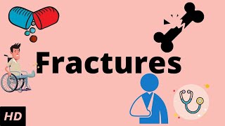 Fractures Causes Signs and Symptoms Diagnosis and Treatment [upl. by Bowie600]