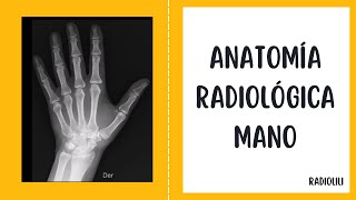 Anatomía Radiológica  Radiología Convencional Mano  Proyección posteroanterior y lateral [upl. by Yenitirb882]