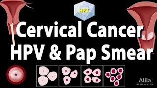 Cervical Cancer HPV and Pap Test Animation [upl. by Enilorak297]