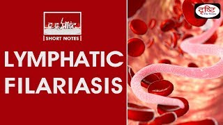 LYMPHATIC FILARIASIS  To The Point [upl. by Hirsh305]