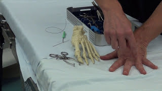 Toe Splay Correction Surgery Explained  Using the Arthrex Plantar Plate Repair System [upl. by Dillon238]