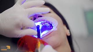 The Essential Role of Light Cure in Modern Dentistry [upl. by Alden741]