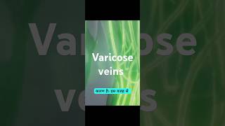 Varicose veinsmedicine healthtipshealth healthcaresymptoms treatmentvaricosevein [upl. by Aivatnahs]