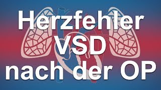 Herzfehler einfach erklärt  Ventrikelseptumdefekt VSD Funktion des Herzens nach der OP [upl. by Adnilav]