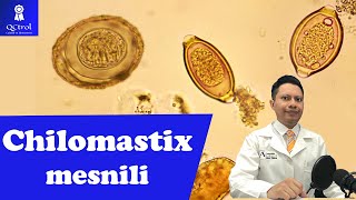 Conoce a Chilomastix mesnili morfología y CLAVES para su identificación🔬 [upl. by Andromede223]