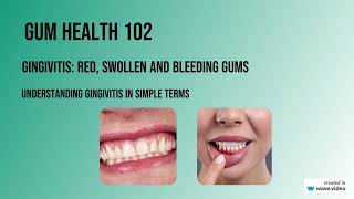 Gum Health 102 Gingivitis Gum Swelling and Bleeding Understanding the Science in Simple Terms [upl. by Rudich]