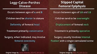 Legg–Calve–Perthes Disease vs Slipped Capital Femoral Epiphysis [upl. by Anisirhc395]