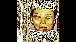 Fetophagia  Puroi FULL split  quotNecrosis Of The Urinary Bladder  Goregrind [upl. by Lamson]