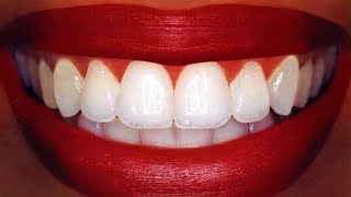 Teeth Whitening At Home In 3 Minutes  How To Whiten Your Yellow Teeth Naturally  100 Effective [upl. by Walli]