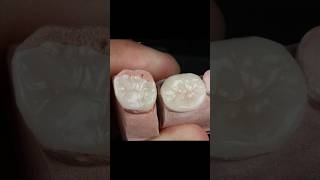 Maquillaje Disilicato de Litio aidite dientes esteticadental [upl. by Yblehs]