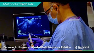 How It Works Endoscopic UltrasoundGuided Radiofrequency Ablation EUSRA [upl. by Asirral]