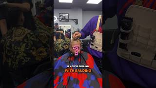 Dealing with hair loss Men’s hair unit service in NYC NYCBARBER menshairunit nybarber [upl. by Rebel]