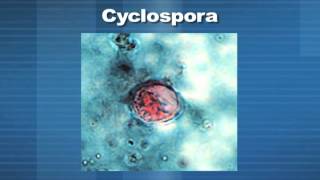 Medical Minute  Cyclospora Parasite [upl. by Engel]