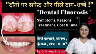 Dental Fluorosis Treatment Cost Home Remedies White Spots On Teeth दाँतों पर सफेद धब्बे [upl. by Rodrique]